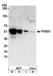 Detection of human and mouse FOXA1 by western blot.