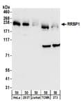 Detection of human and mouse RRBP1 by western blot.