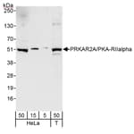 Detection of human PRKAR2A/PKA-RIIalpha by western blot.