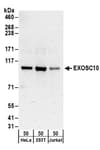 Detection of human EXOSC10 by western blot.