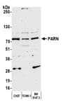 Detection of mouse PARN by western blot.