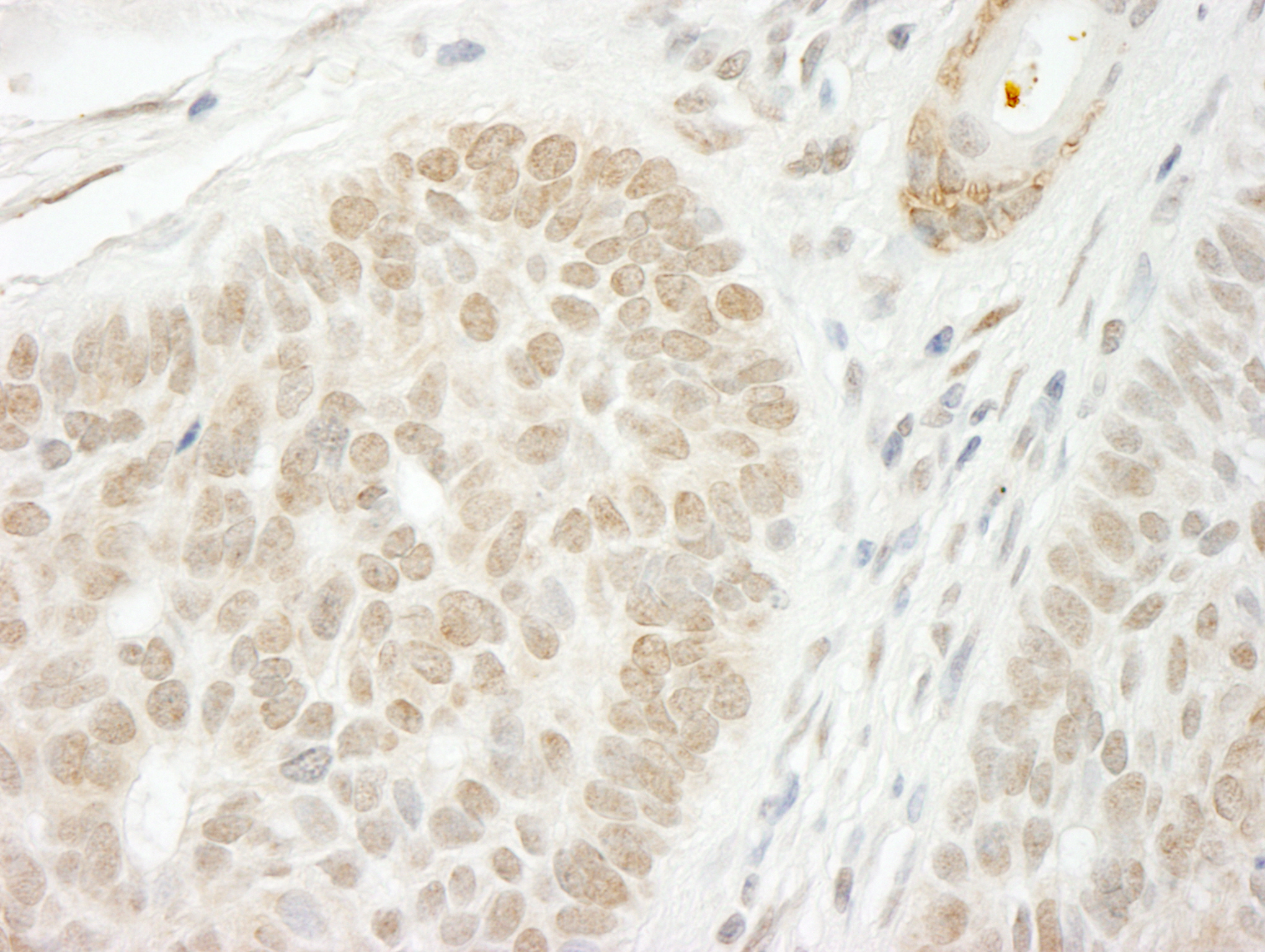 Rabbit anti-CSTF2T/TauCSTF64 IHC Antibody