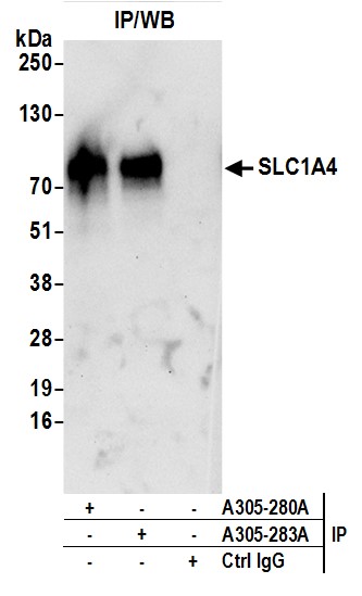 Detection of human SLC1A4 by western blot of immunoprecipitates.