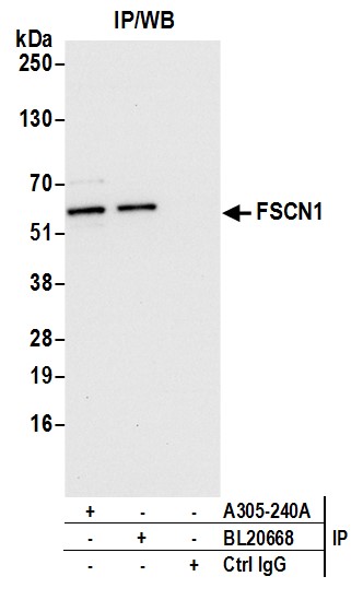 Detection of human FSCN1 by western blot of immunoprecipitates.