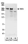 Detection of human TET2 by western blot.