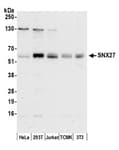 Detection of human and mouse SNX27 by western blot.