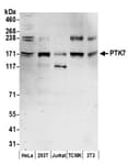 Detection of human and mouse PTK7 by western blot.