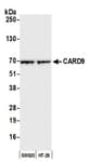 Detection of human CARD9 by western blot.