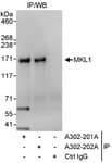 Detection of human MKL1 by western blot of immunoprecipitates.