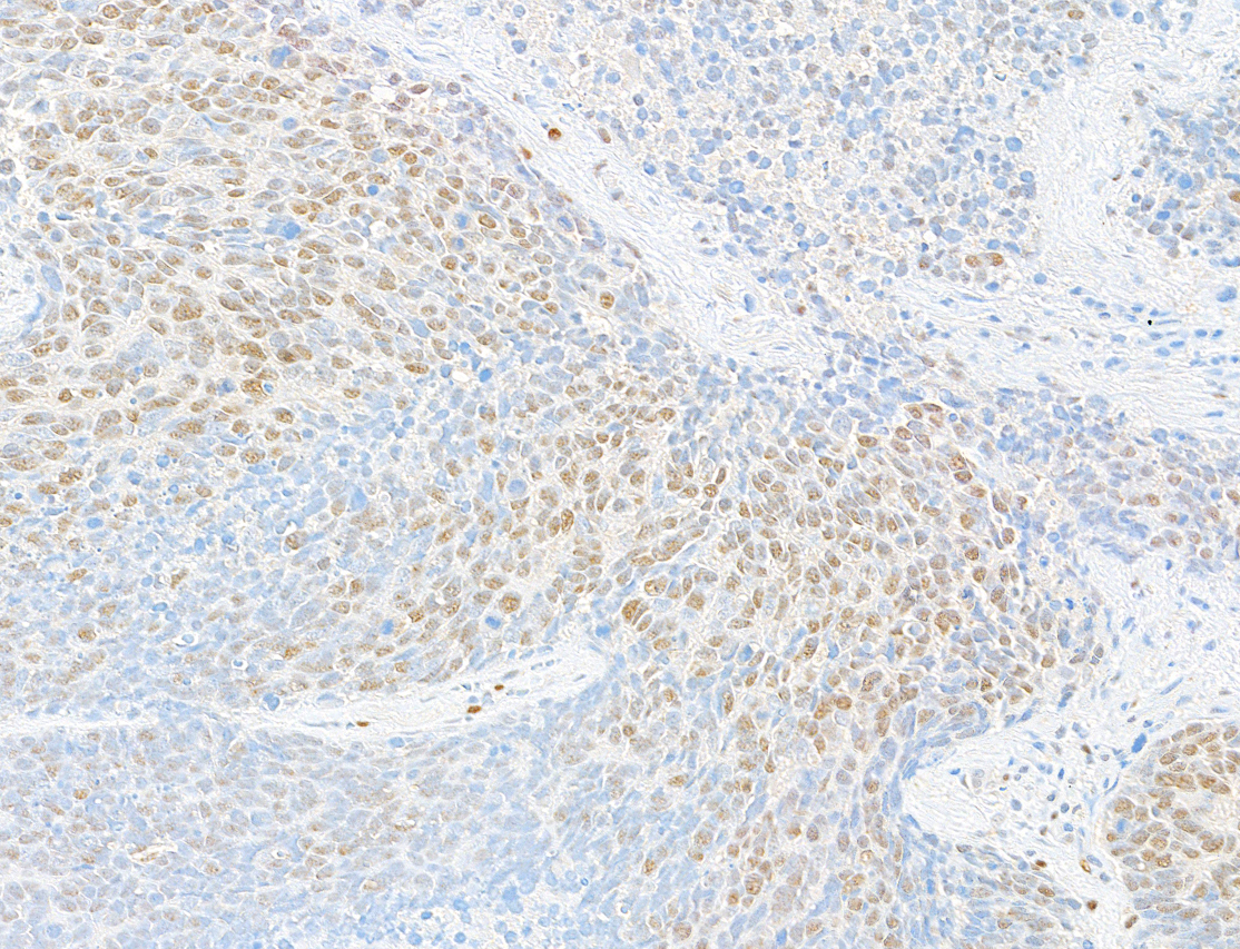 Detection of mouse RBM9 (shaded) in EL4 cells by flow cytometry.