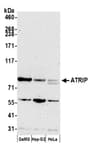 Detection of human ATRIP by western blot.