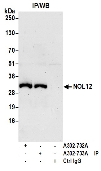 Detection of human NOL12 by western blot of immunoprecipitates.