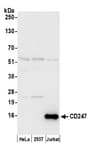 Detection of human CD247 by western blot.