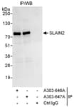 Detection of human SLAIN2 by western blot of immunoprecipitates.