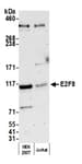 Detection of human E2F8 by western blot.