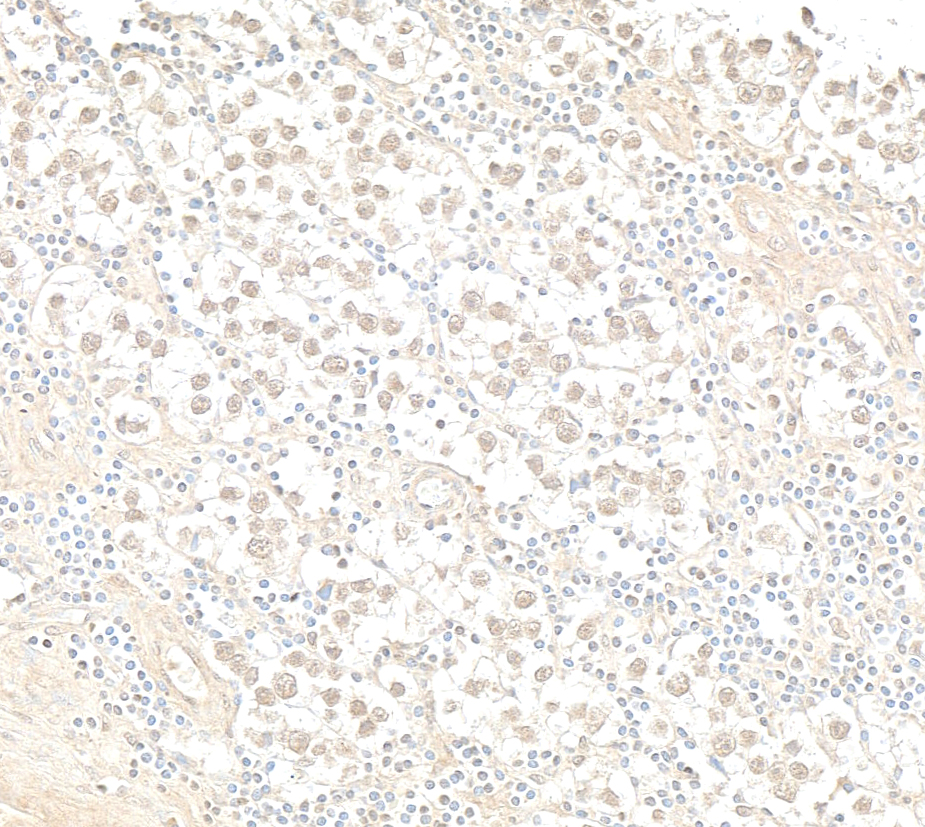 Detection of human CPSF59 by immunohistochemistry.