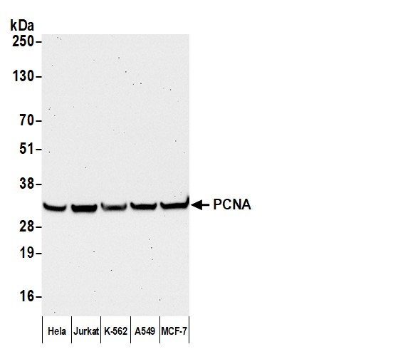 Detection of human PCNA by western blot with Affinity Purified Goat anti-Mouse IgG Heavy and Light Chain Human-Adsorbed Antibody.