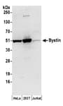 Detection of human Bystin by western blot.
