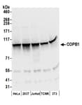 Detection of human and mouse COPB1 by western blot.