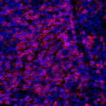 Detection of human CD247/CD3Z (red) by immunohistochemistry.