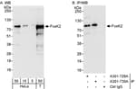 Detection of human FOXK2 by western blot and immunoprecipitation.