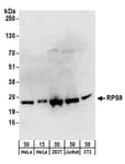 Detection of human and mouse RPS9 by western blot.