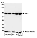 Detection of human SRF by western blot.