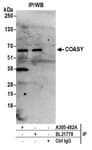 Detection of human COASY by western blot of immunoprecipitates.