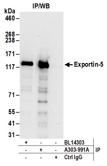 Detection of human Exportin-5 by western blot of immunoprecipitates.