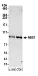 Detection of mouse NBS1 by western blot.
