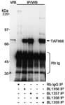 Detection of human TAFII68 by western blot and immunoprecipitation.
