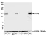 Detection of human CD11c by western blot.