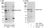 Detection of human NUP160 by western blot and immunoprecipitation.