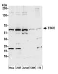 Detection of human and mouse TBCE by western blot.