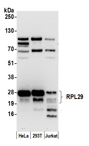 Detection of human RPL29 by western blot.