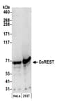Detection of human CoREST by western blot.
