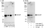 Detection of human SSX2IP by western blot and immunoprecipitation.