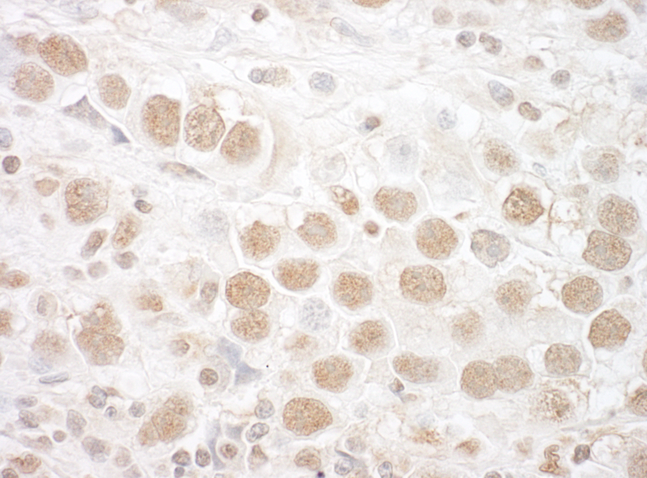 Detection of human CTNNBL1 by immunohistochemistry.