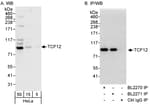 Detection of human TCF12 by western blot and immunoprecipitation.
