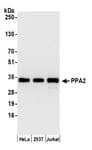 Detection of human PPA2 by western blot.