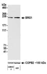 Detection of mouse BRG1 by western blot.