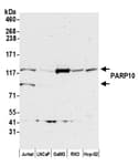 Detection of human PARP10 by western blot.