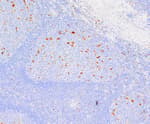 Detection of human Macrophage by immunohistochemistry.