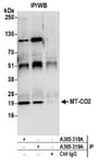 Detection of human MT-CO2 by western blot of immunoprecipitates.