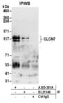 Detection of human CLCN7 by western blot of immunoprecipitates.