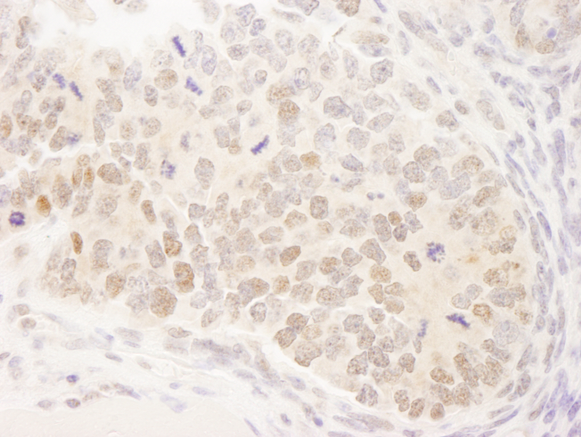 Detection of mouse MAML3 by immunohistochemistry.