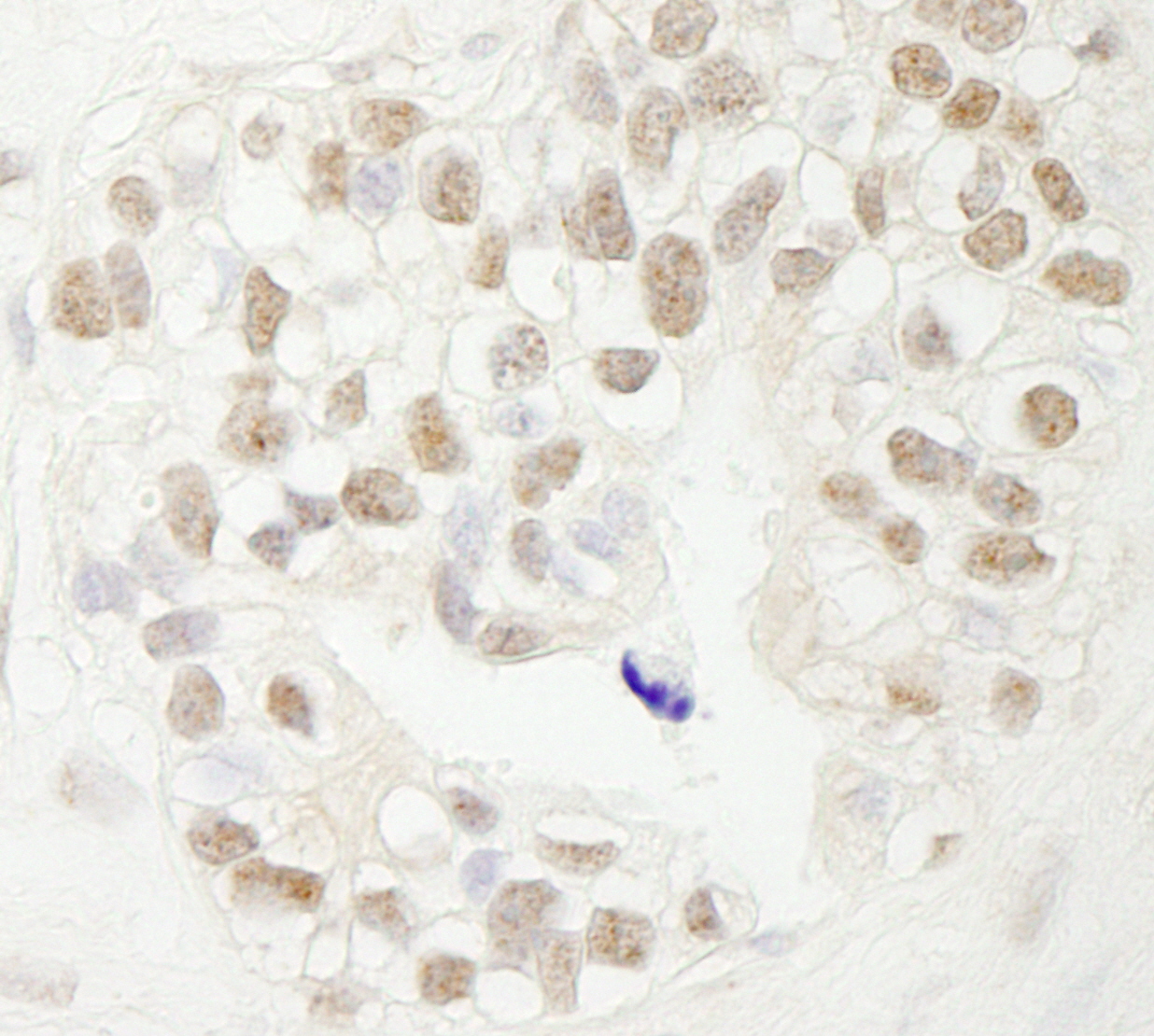 Rabbit anti-FBW7 IHC Antibody