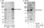 Detection of human FANCD2 by western blot and immunoprecipitation.