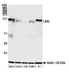 Detection of mouse AXL by western blot.