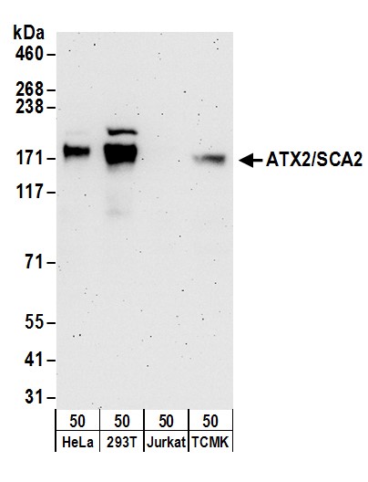 Detection of human and mouse ATX2/SCA2 by western blot.